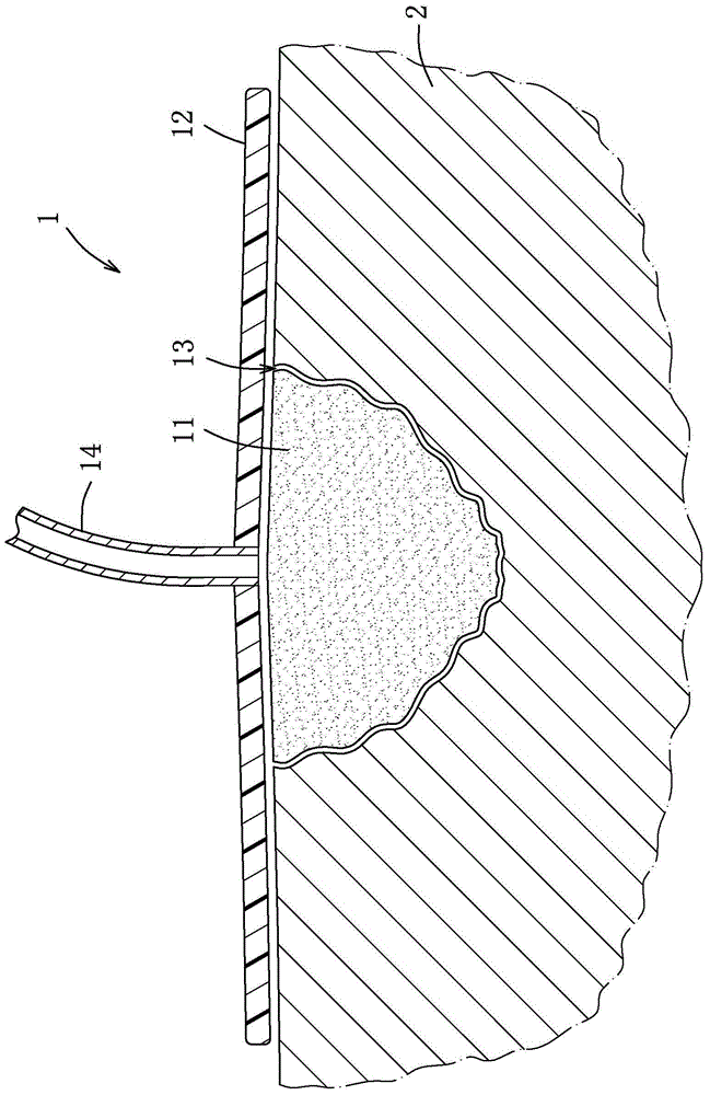 Negative pressure therapeutic apparatus