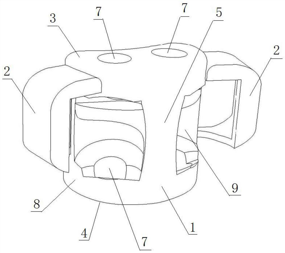 Personalized artificial vertebral implant and its design method based on additive manufacturing