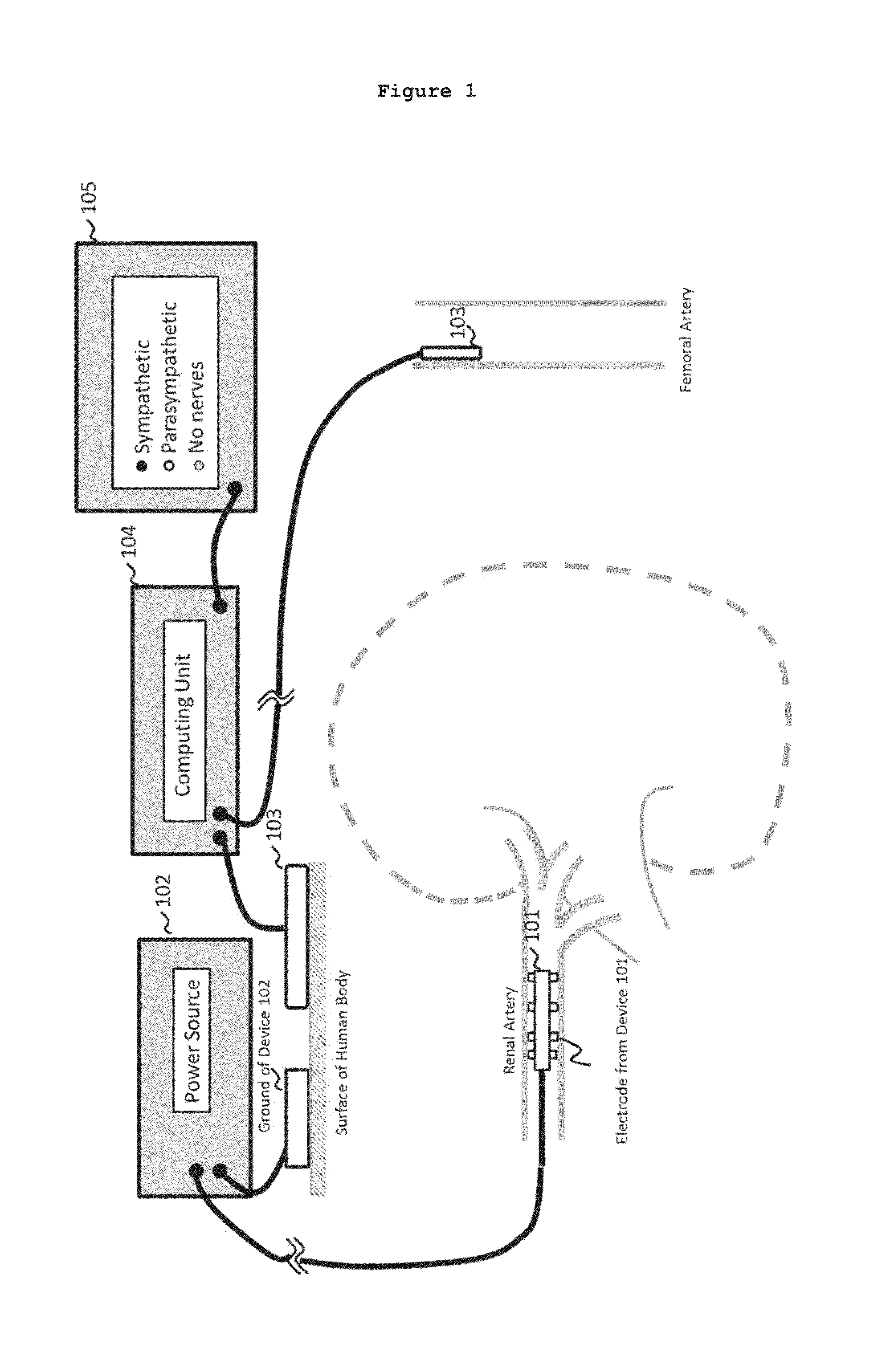 System and method for locating and identifying the functional nerves innervating the wall of arteries and catheters for same