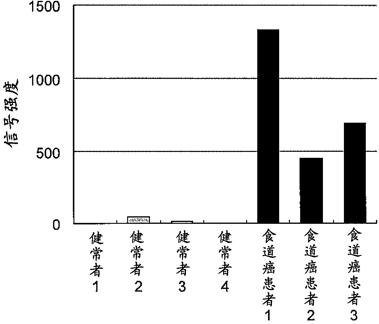 Marker for detecting colorectal cancer or esophageal cancer and method for inspecting same