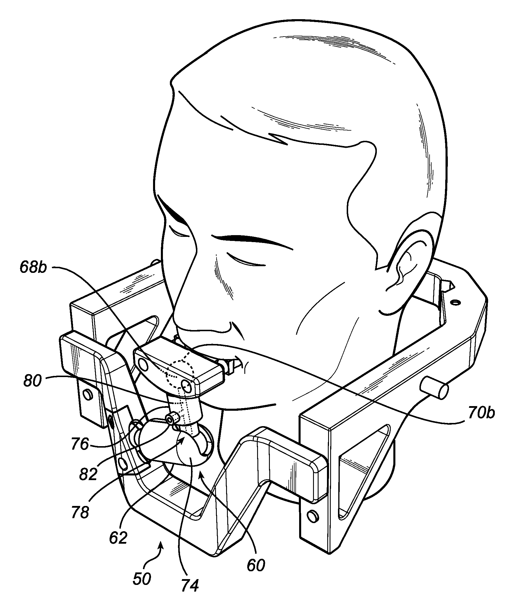 Fixation device