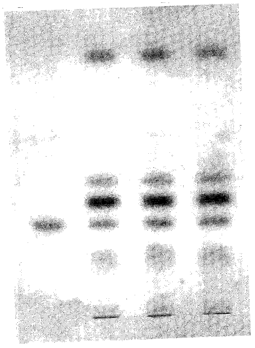 Process for clarification of pharmaceutical composition having face couperose skin treatment effect and quality control method