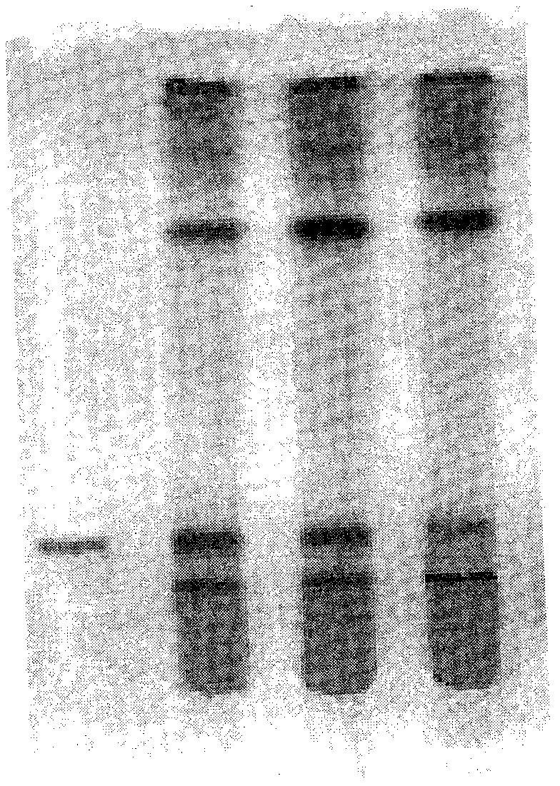 Process for clarification of pharmaceutical composition having face couperose skin treatment effect and quality control method