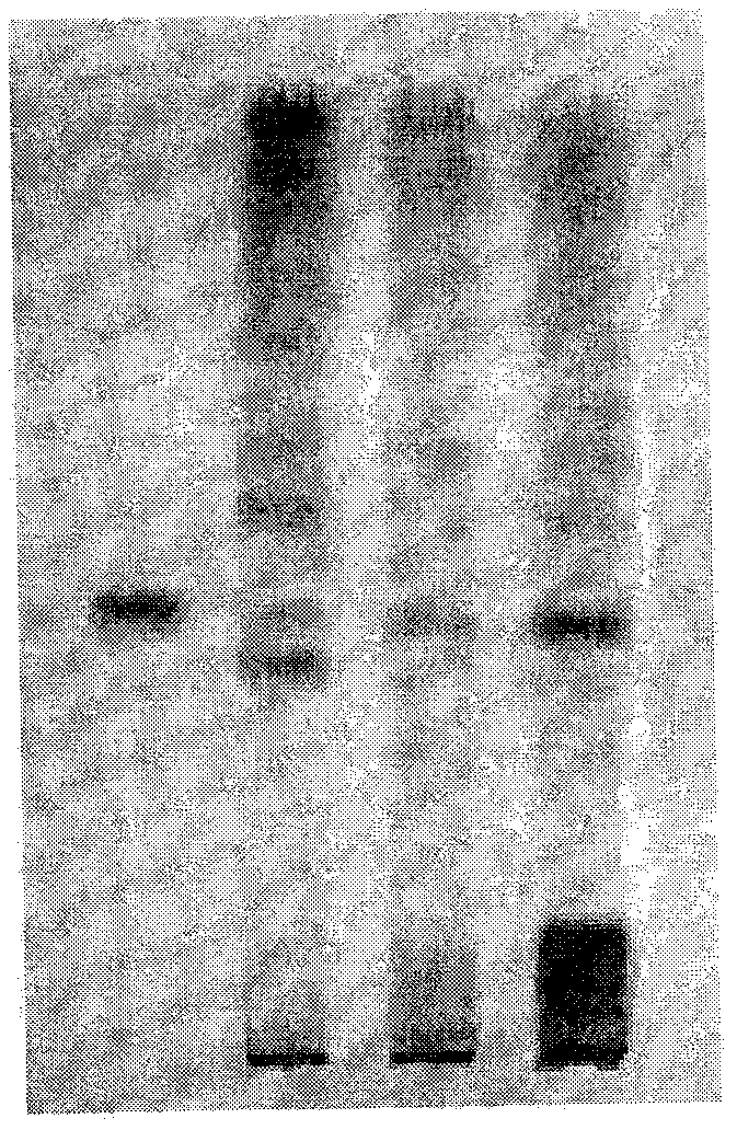 Process for clarification of pharmaceutical composition having face couperose skin treatment effect and quality control method