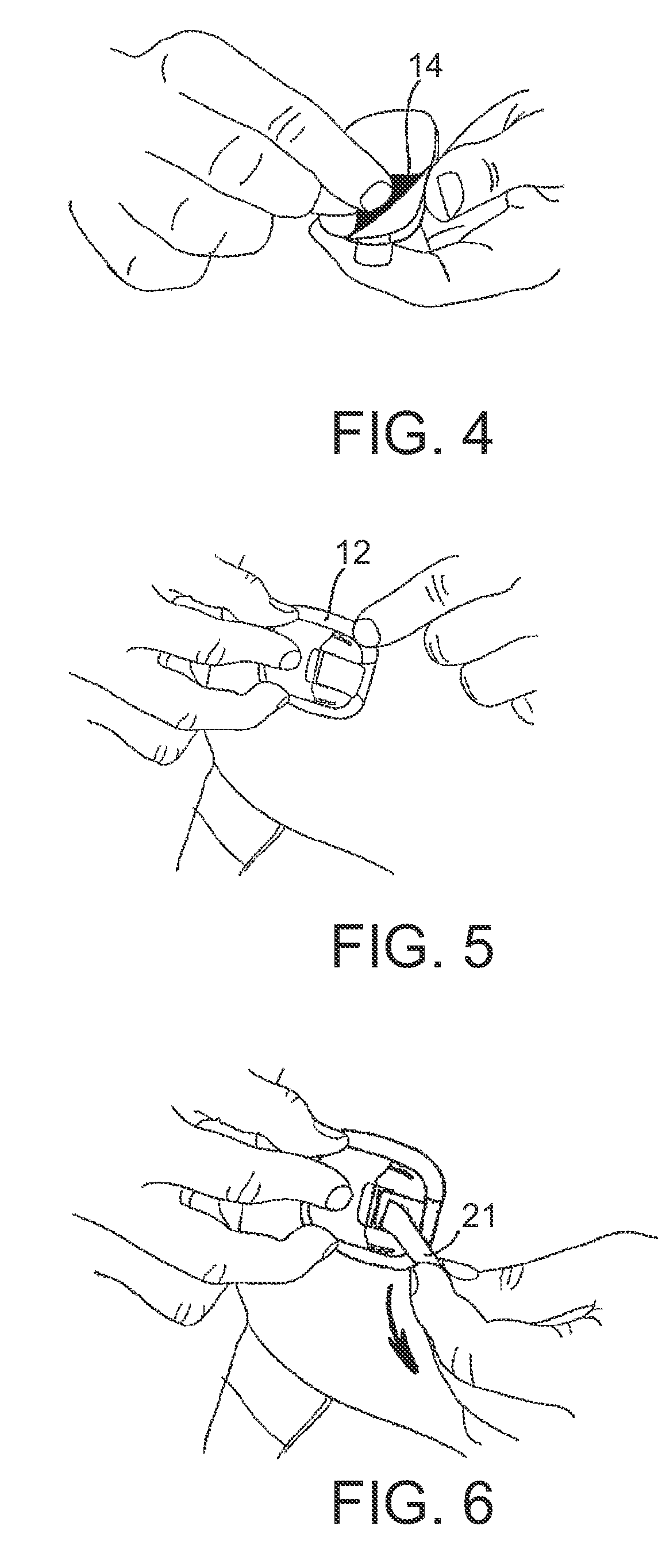 Medical Skin Mountable Device