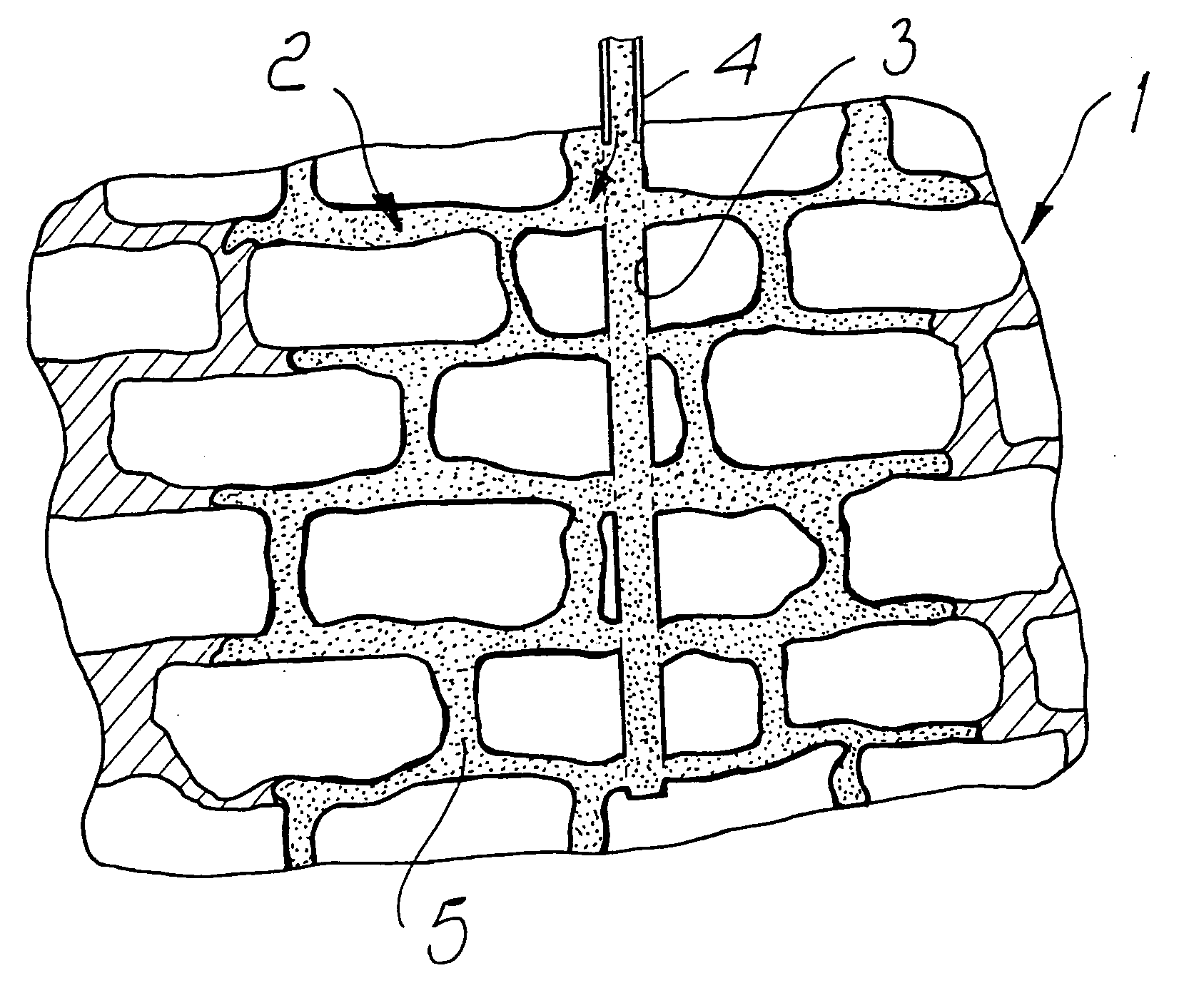 Method for repairing, waterproofing, insulating, reinforcing, restoring of wall systems