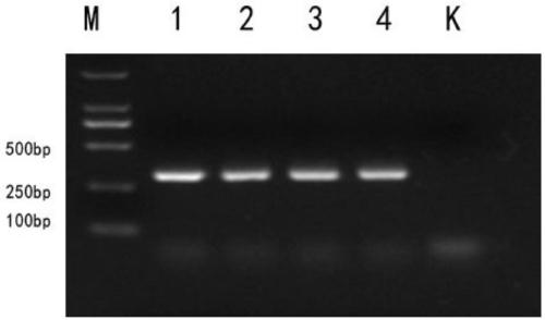 PCR detection method and kit for francisella tularensis and subspecies of francisella tularensis