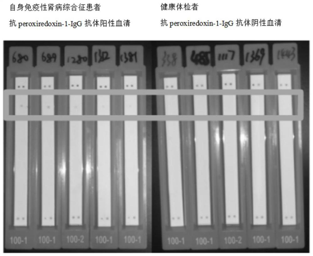 A kit for detecting anti-peroxide reductase-1-igg antibody