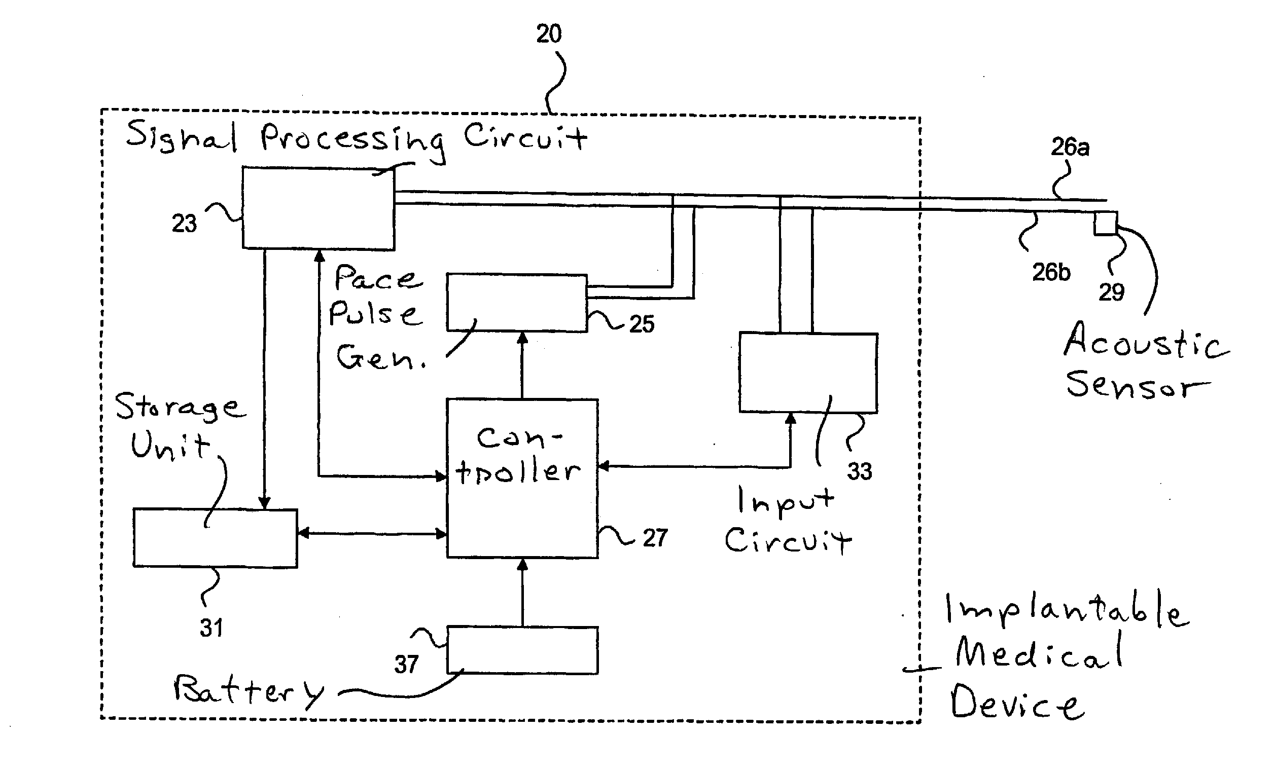 Implantable medical device with optimization procedure