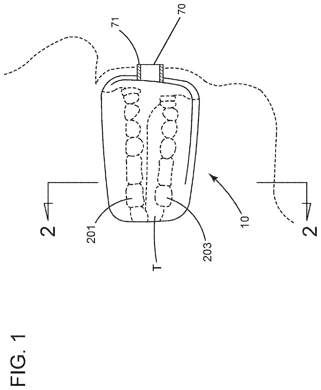 Hand-held therapeutic oral device for cooling of oral tissue of a user