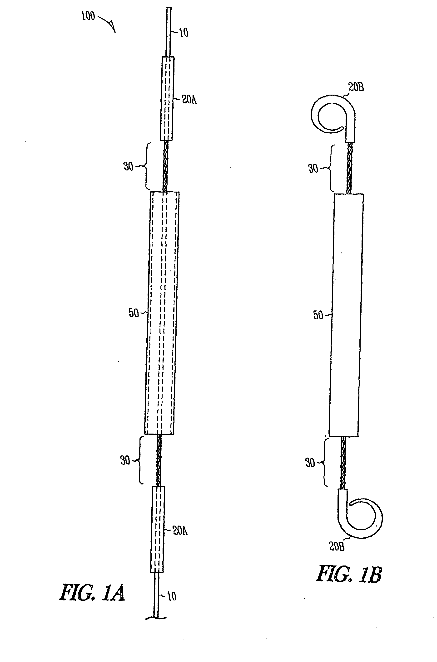 Ureteral stent with axial and radial variability