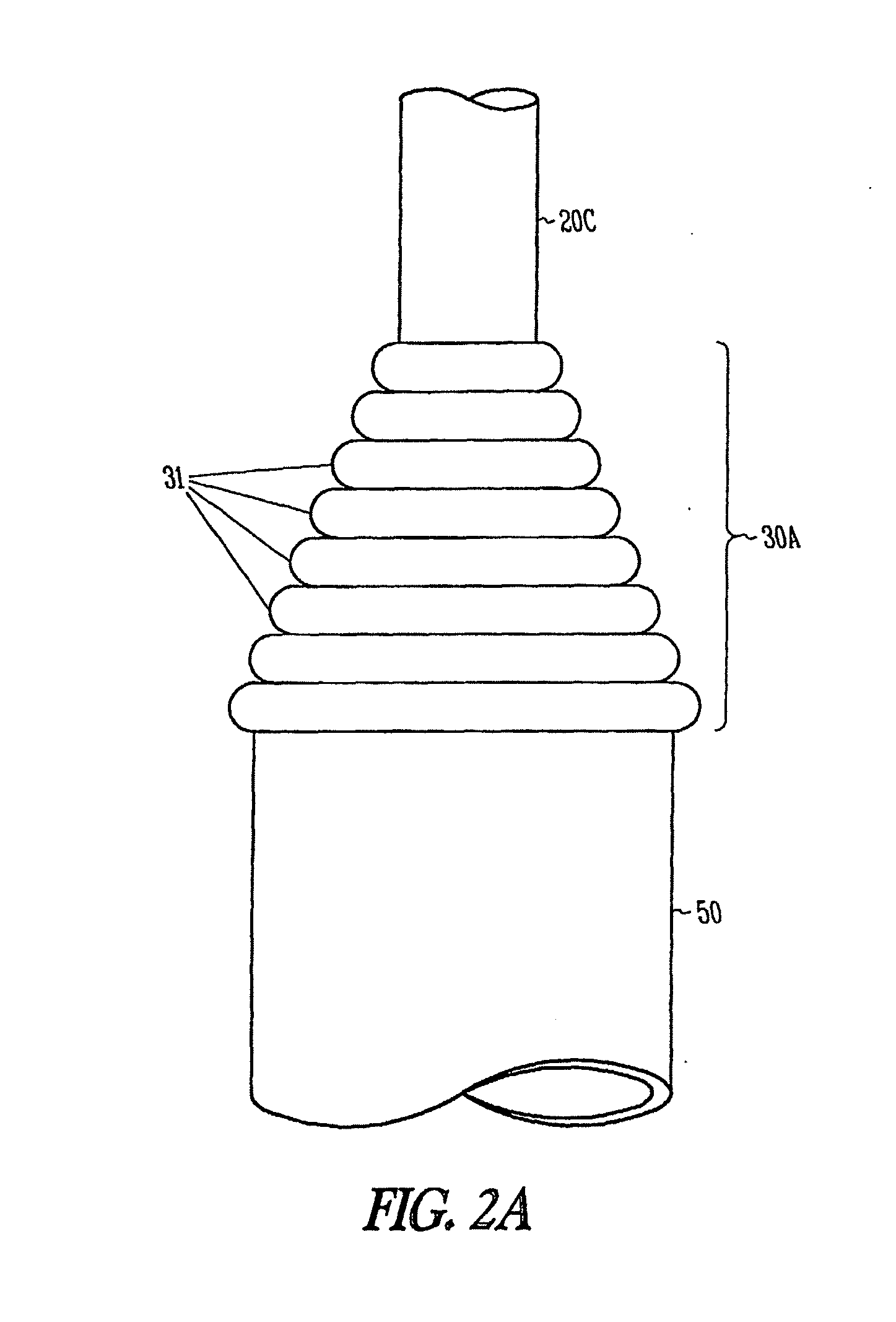 Ureteral stent with axial and radial variability