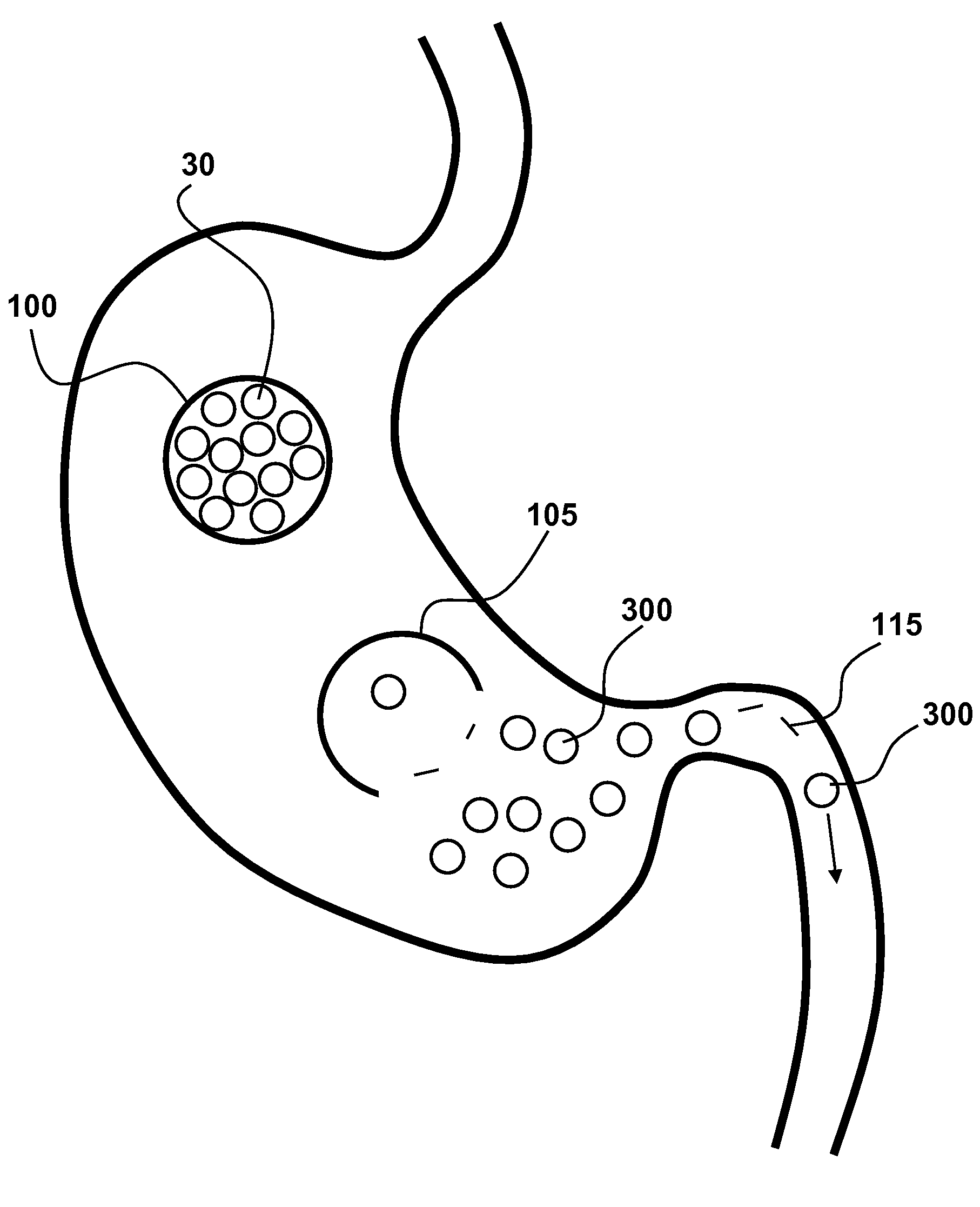 Swallowable self-expanding gastric space occupying device