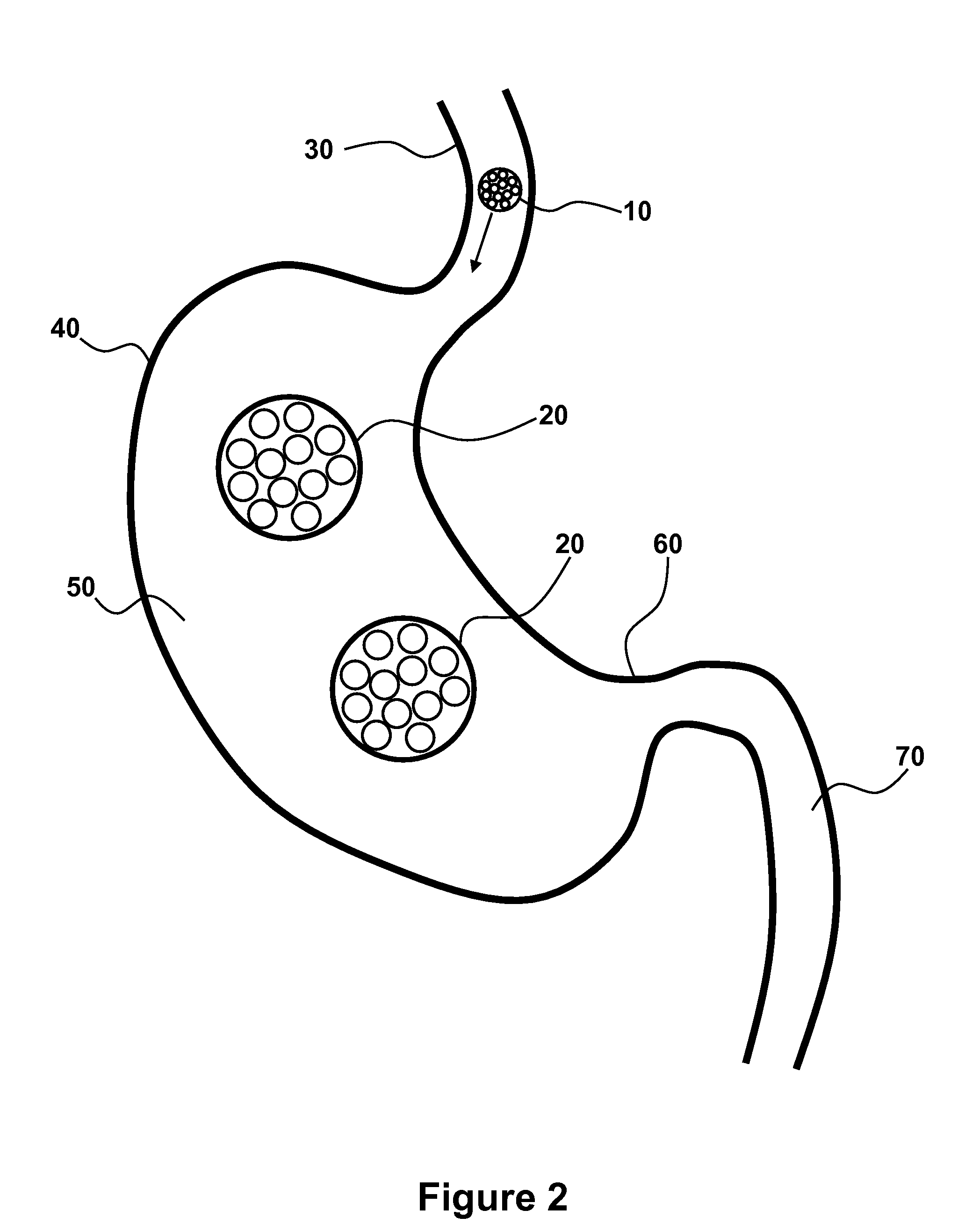 Swallowable self-expanding gastric space occupying device