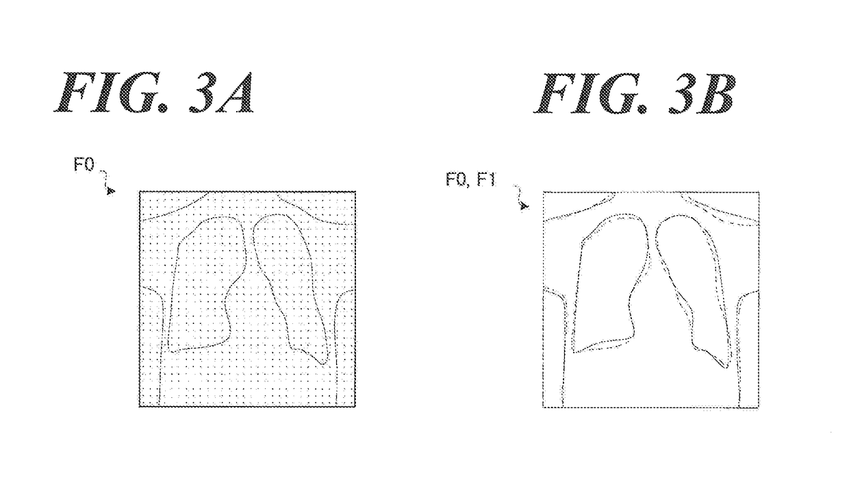 Image processing device