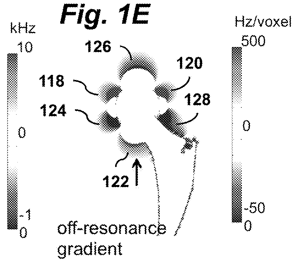 Alternating Gradients for Metal-Induced Artifacts Correction in Magnetic Resonance Imaging