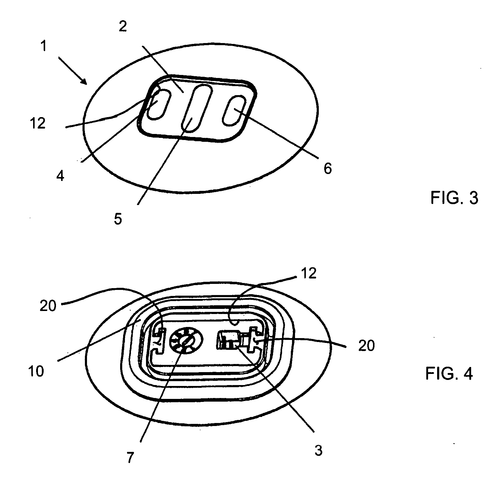 Internal socket and fitting system for a prosthesis