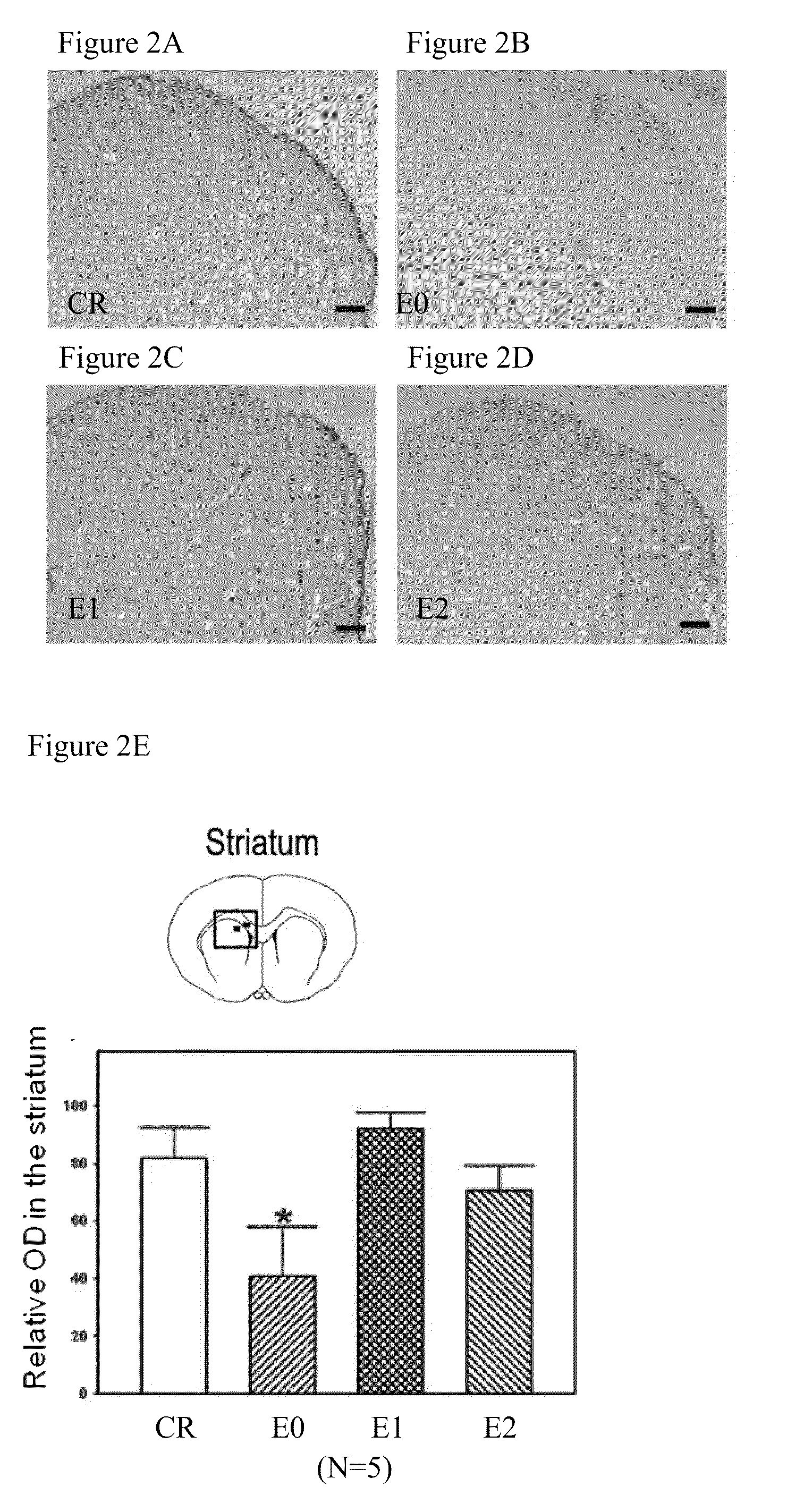 Method of Treating a Neurodegenerative Disorder