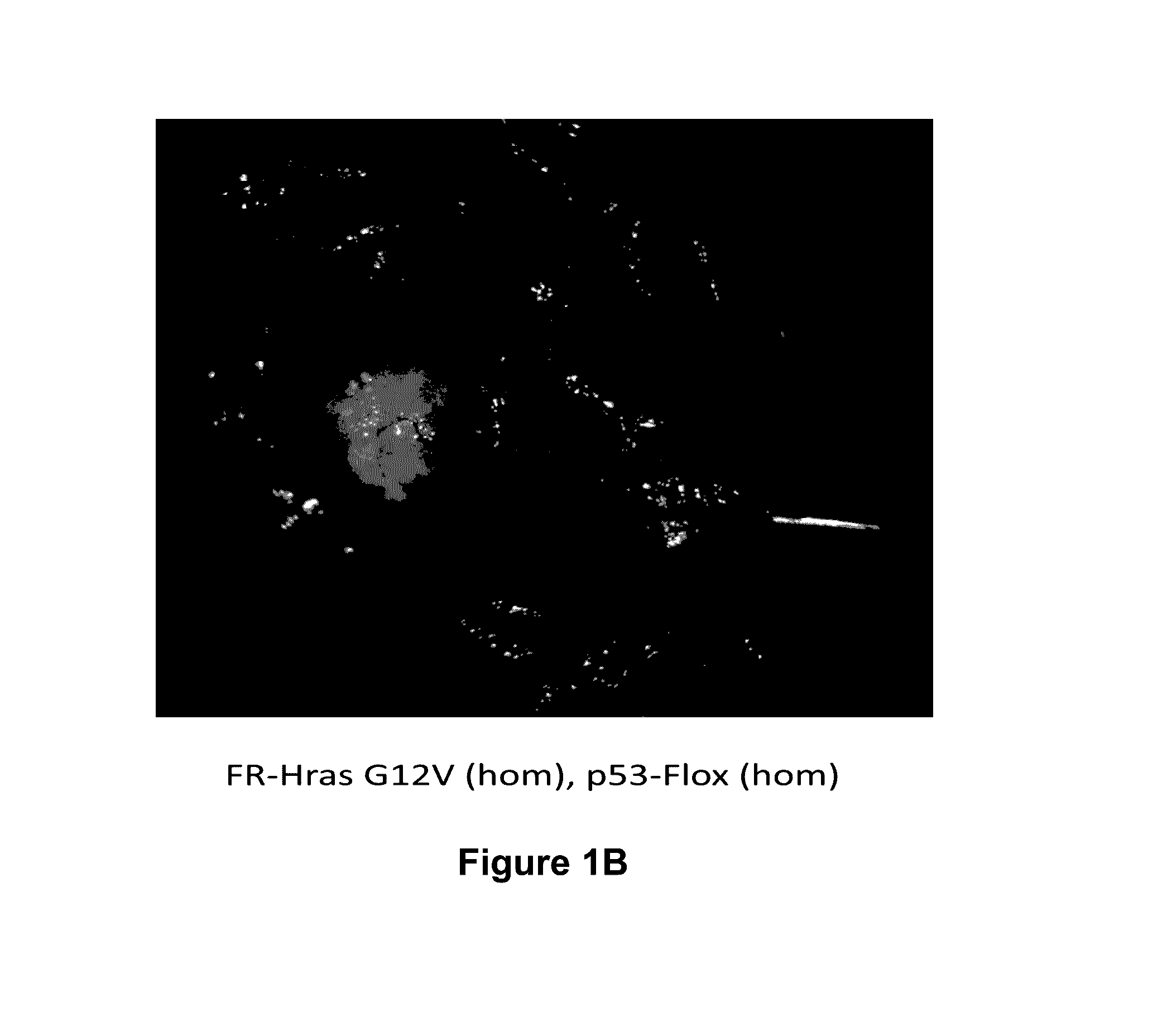 Treatment of h-ras-driven tumors