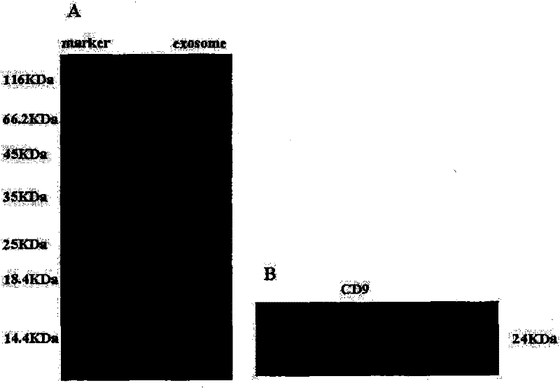 Human umbilical cordmesenchymal stem cell-derived exosome and application thereof