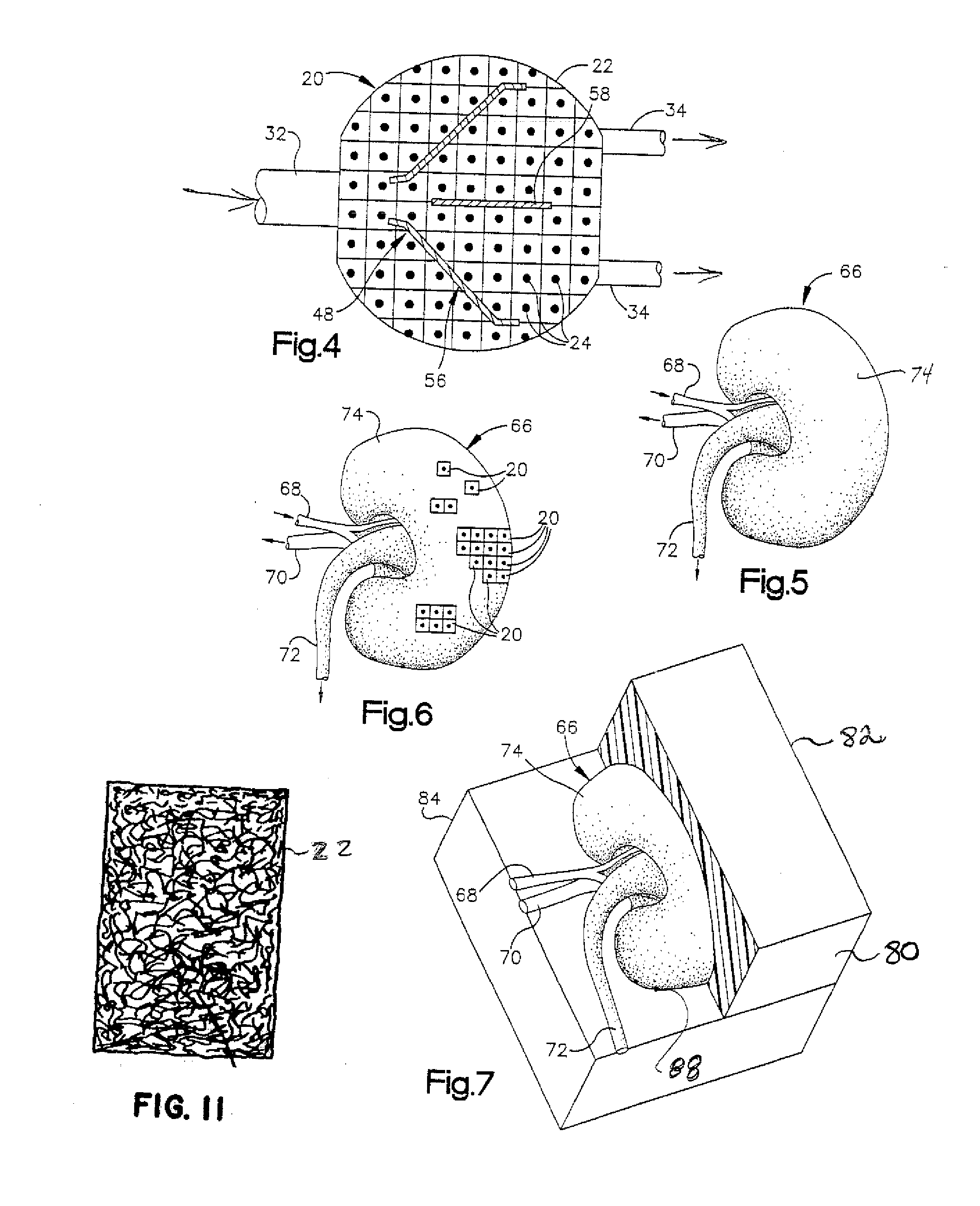 Scaffold and method for implanting cells