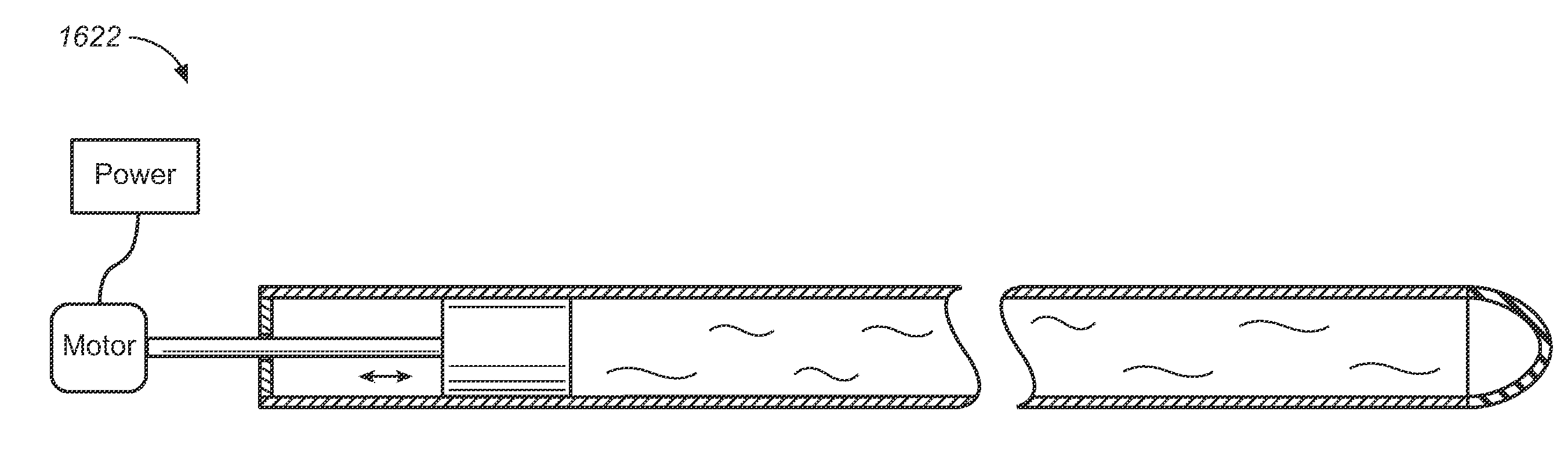 Hydrodynamic Thrombectomy Catheter