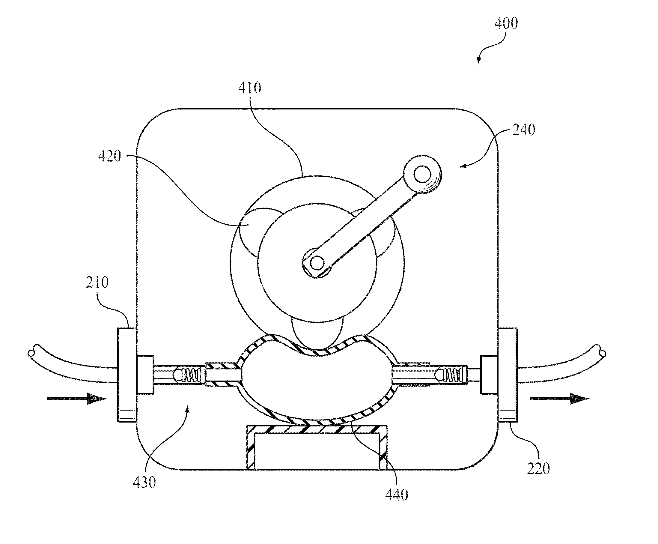 Manual pump for intravenous fluids