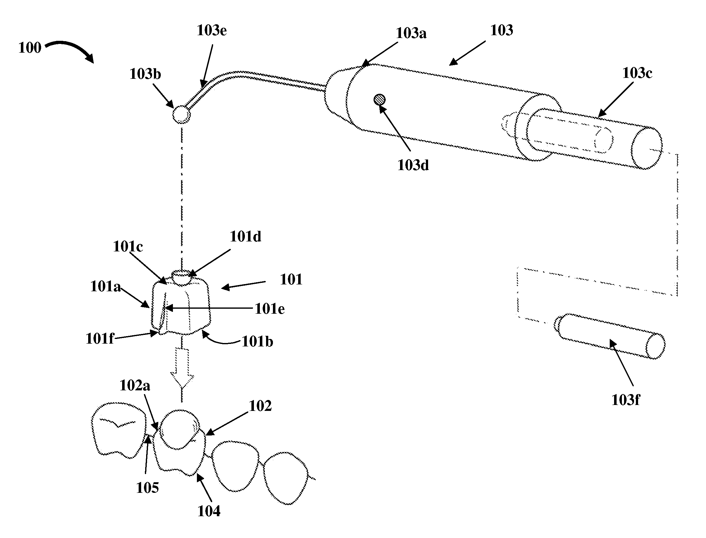 Tooth Loosening And Removal Apparatus With A Motion Transfer Member