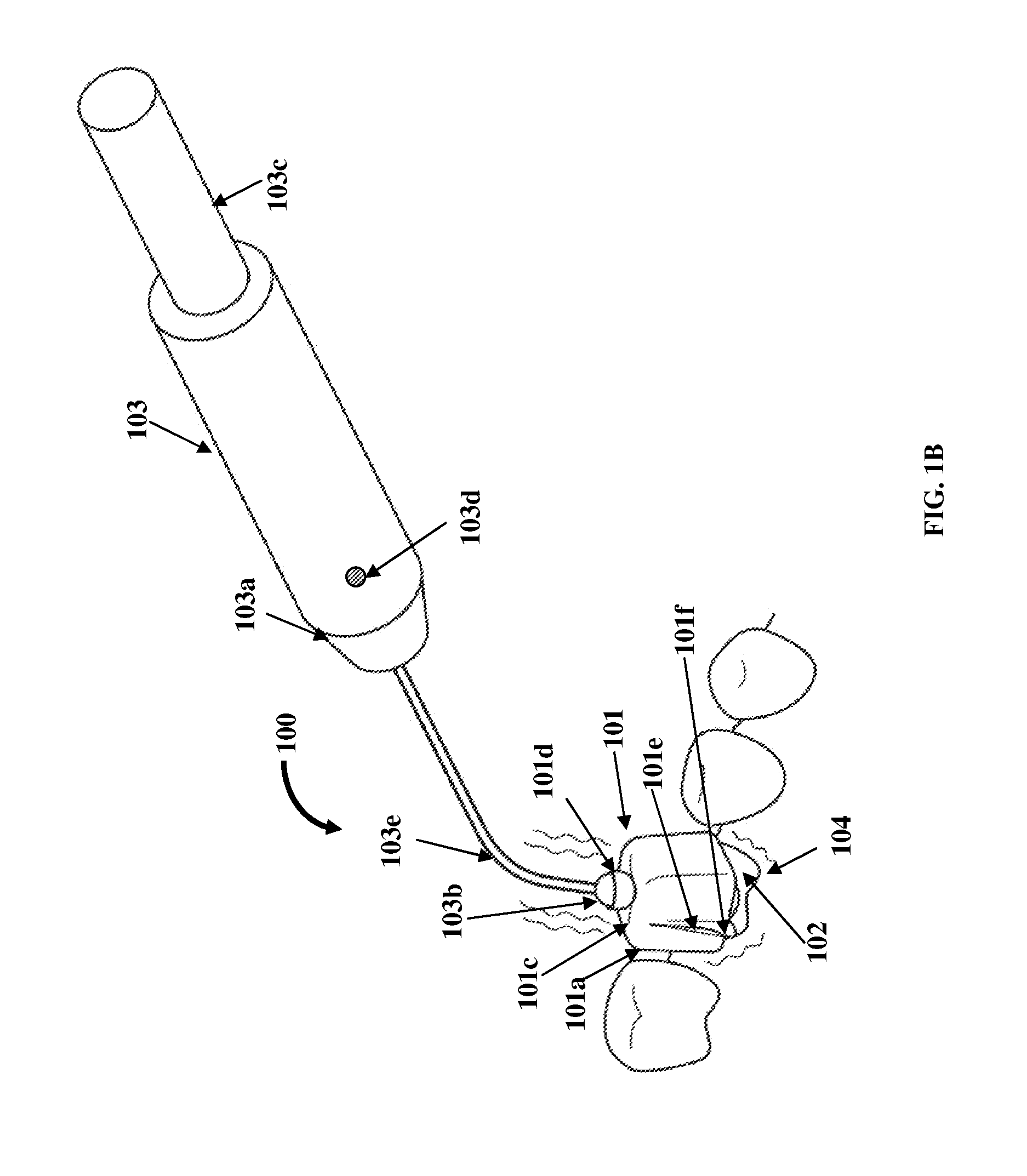 Tooth Loosening And Removal Apparatus With A Motion Transfer Member