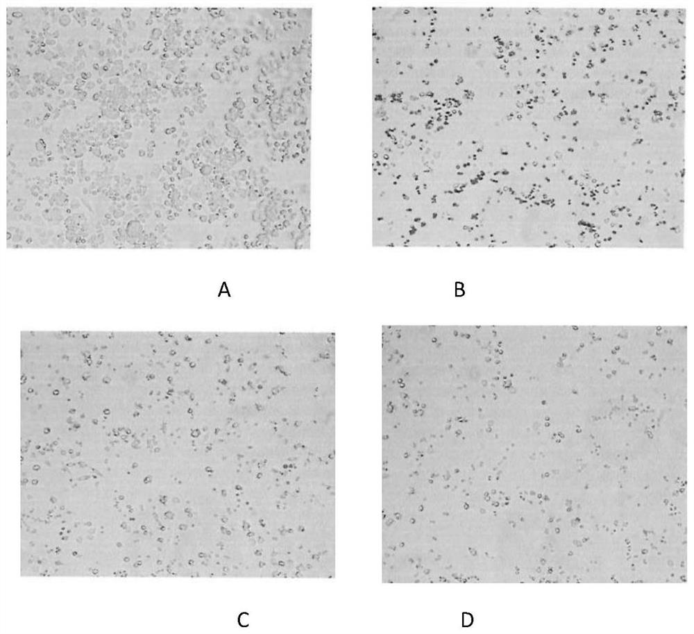 Pharmaceutical composition containing monosialotetrahexosyl ganglioside sodium and application thereof