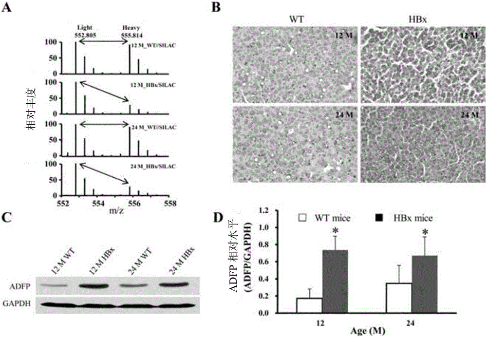 Novel use of adipogenic differentiation-associated proteins as screening markers for HBV-HCC patients