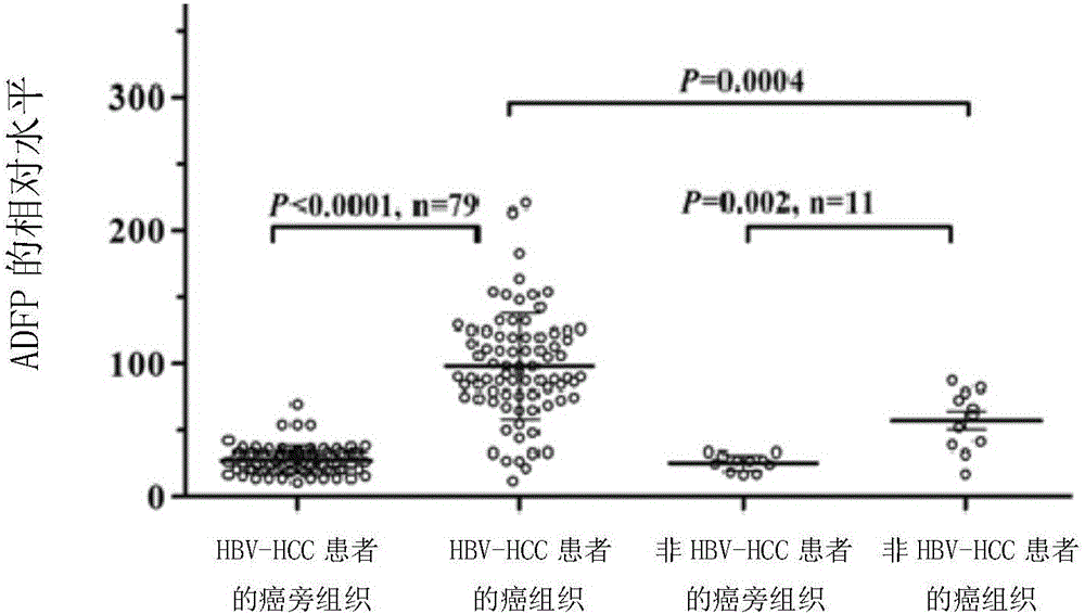 Novel use of adipogenic differentiation-associated proteins as screening markers for HBV-HCC patients