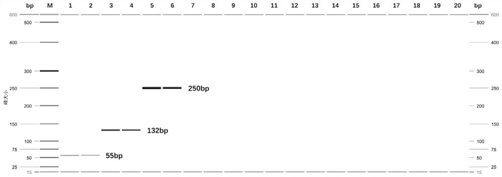 Multiple PCR (polymerase chain reaction) detection kit for anopheles peditaeniatus, anopheles lesteri and anopheles barbirostris