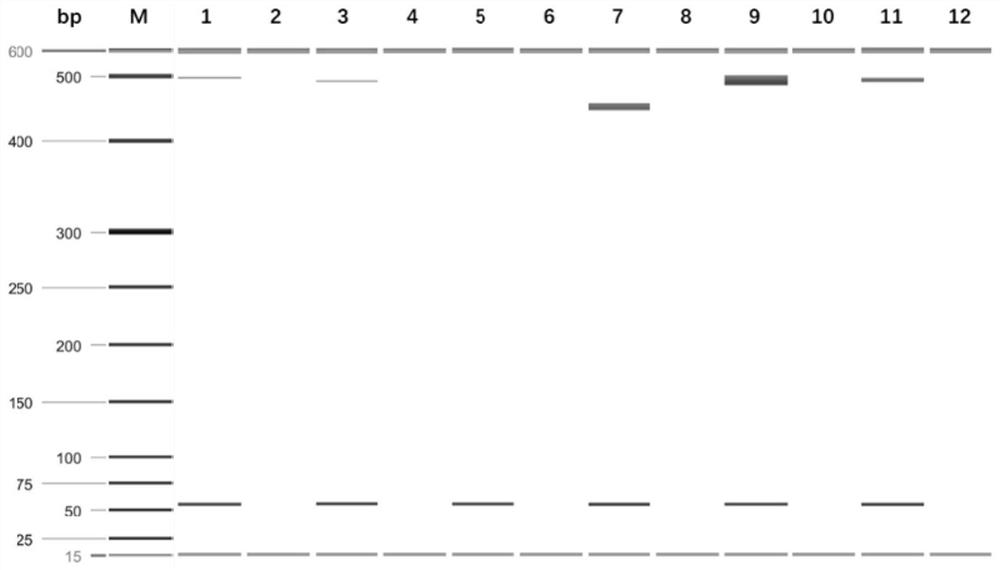 Multiple PCR (polymerase chain reaction) detection kit for anopheles peditaeniatus, anopheles lesteri and anopheles barbirostris