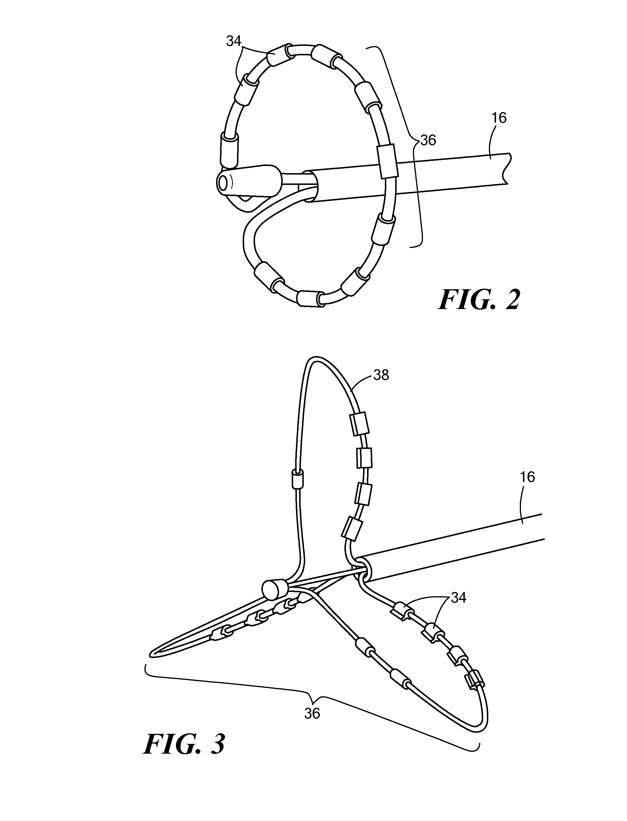 Impedance detection of venous placement of multi-electrode catheters