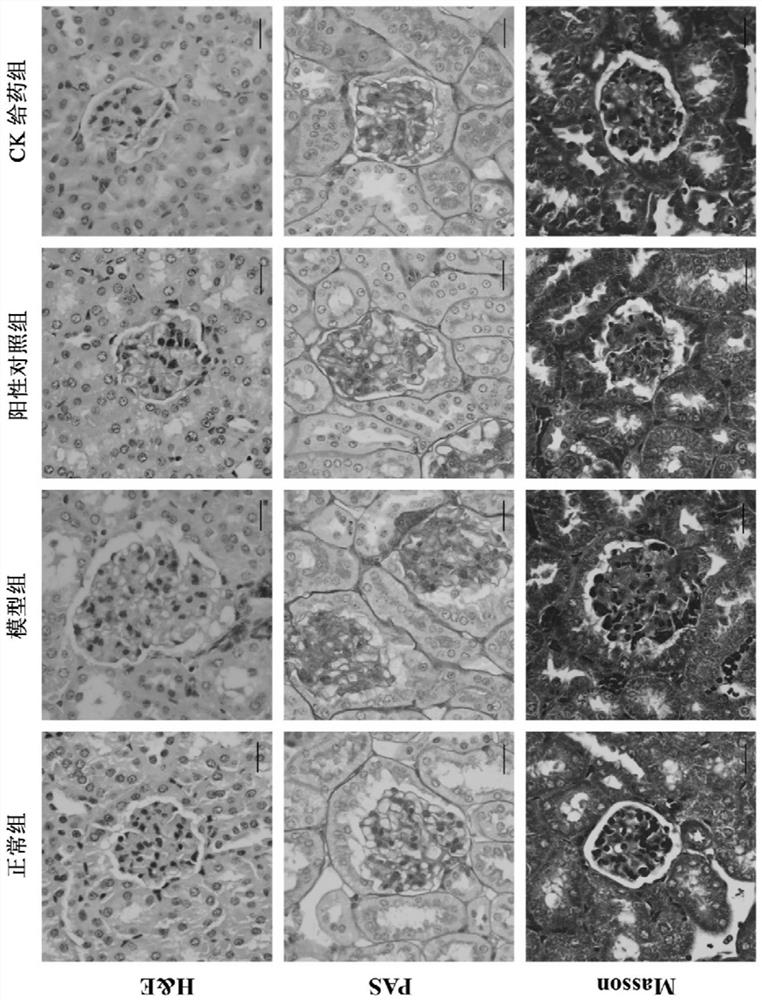 Application of ginsenoside compound K in preparation of medicine for treating diabetic kidney diseases