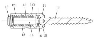 Scoliosis Screw Rod Correction Bracket System