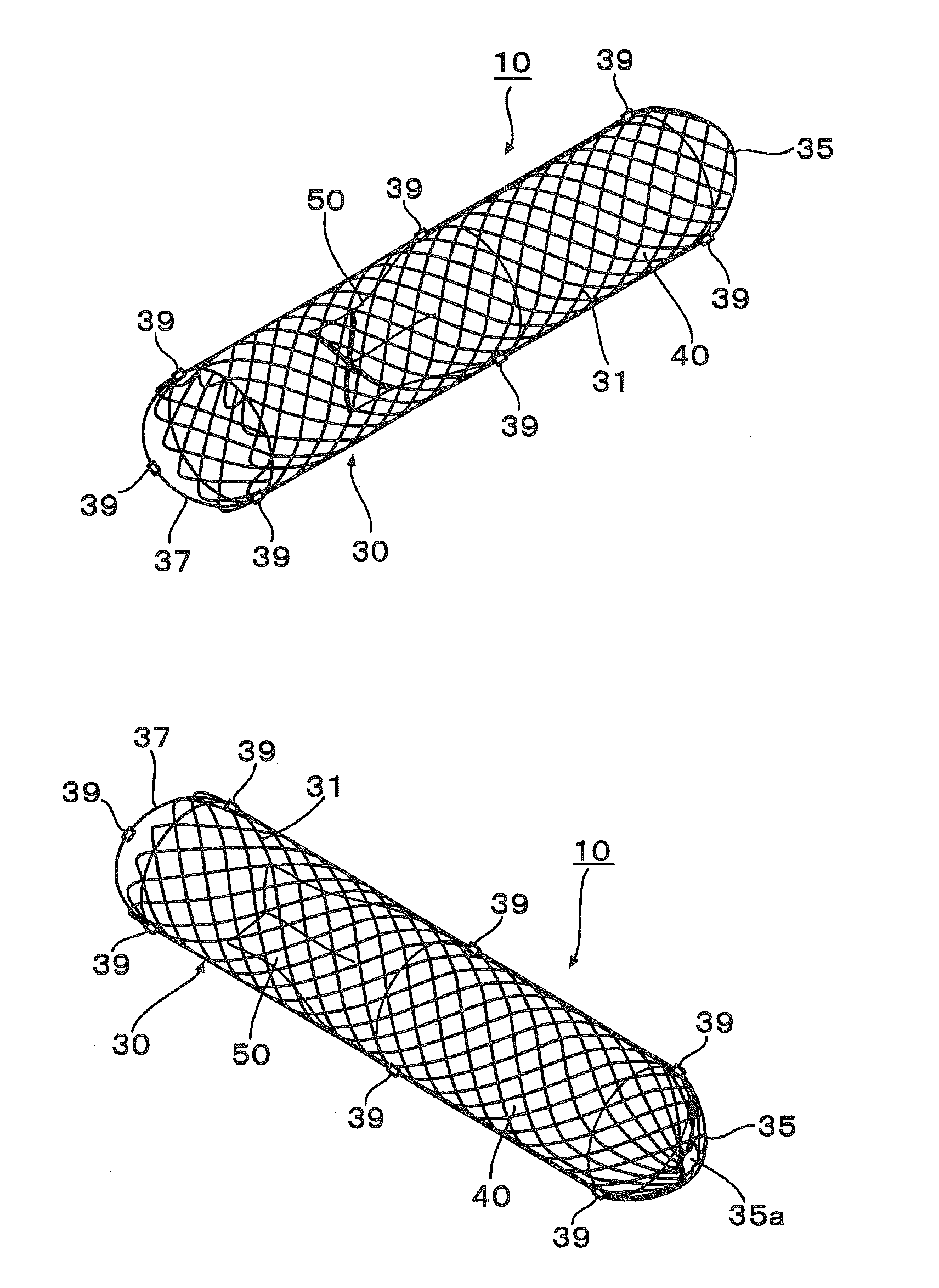 Abdominal cavity-vein shunt stent