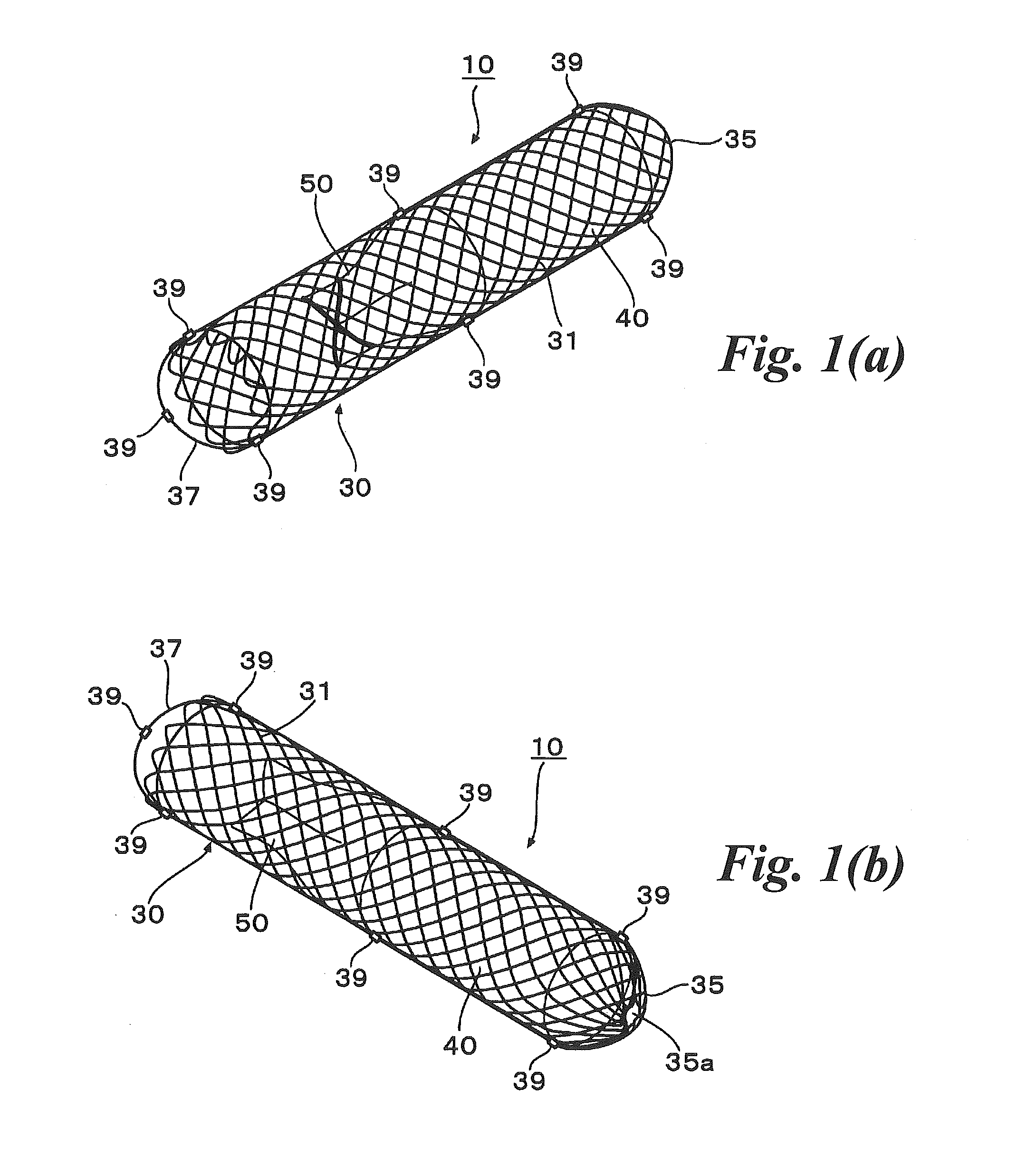 Abdominal cavity-vein shunt stent