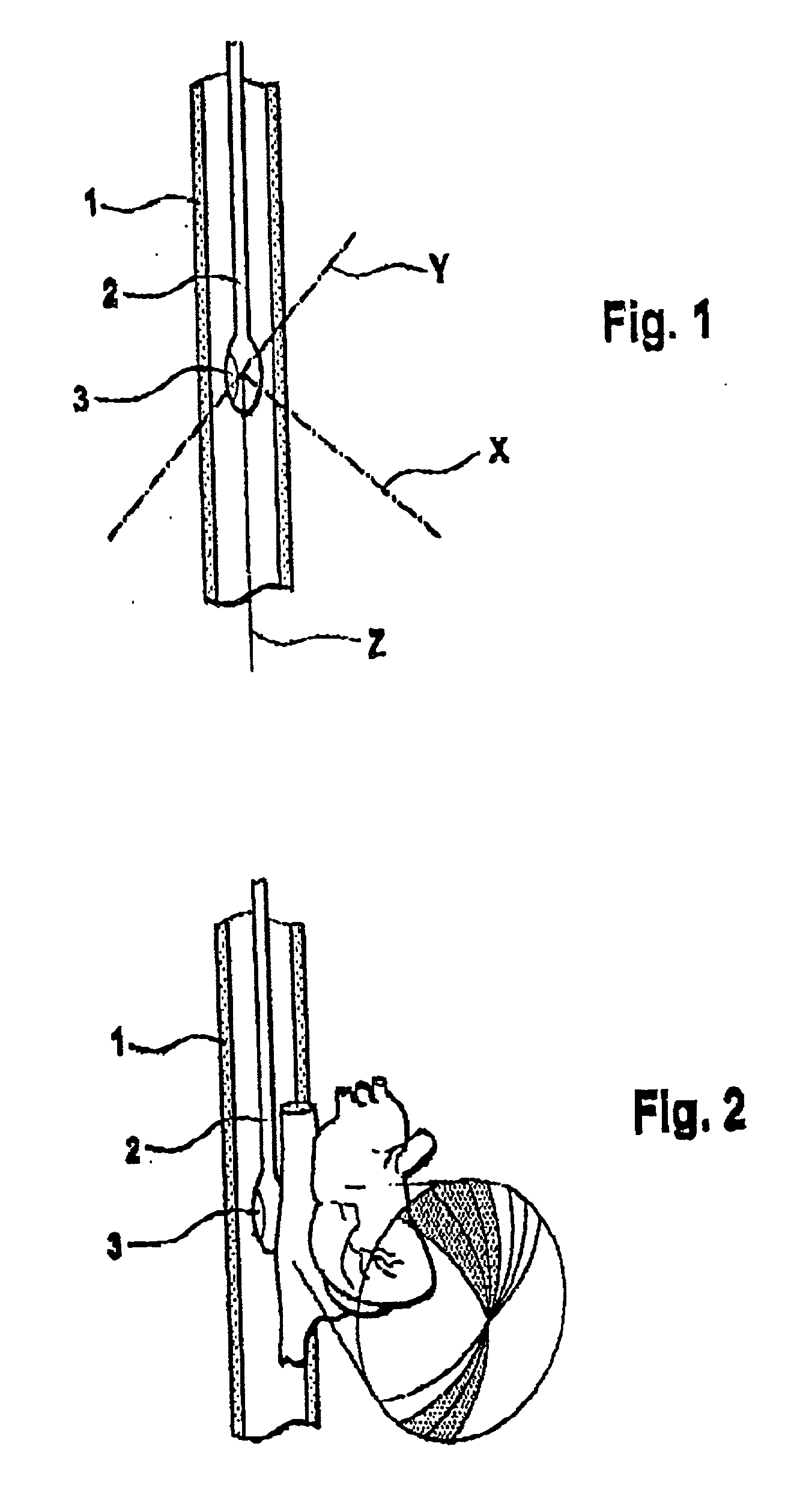 Pneumatic control apparatus for an endoscope