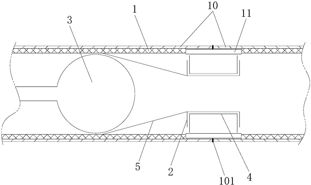 Tracheal anastomosis device