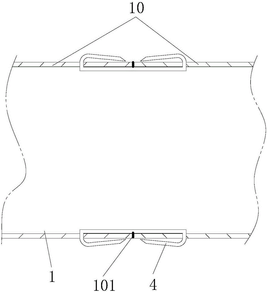 Tracheal anastomosis device