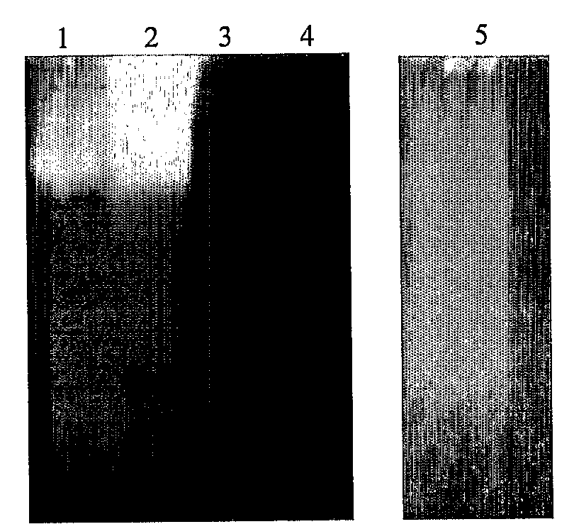 Methods and compositions for controlling ectoparasites