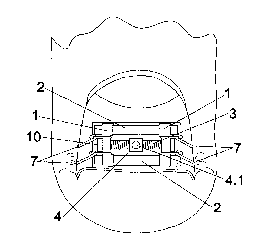 Screw nail correcting apparatus