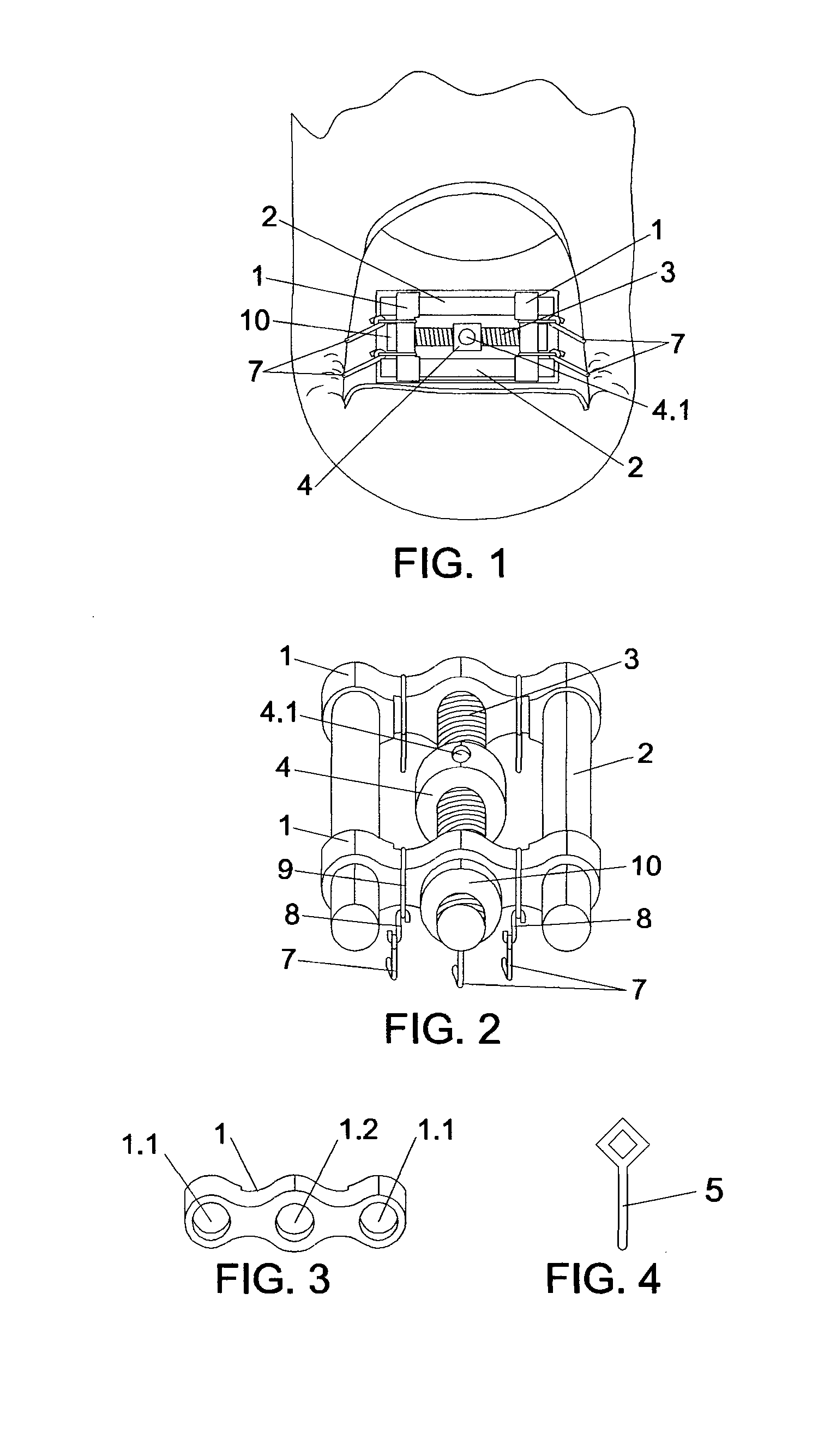 Screw nail correcting apparatus