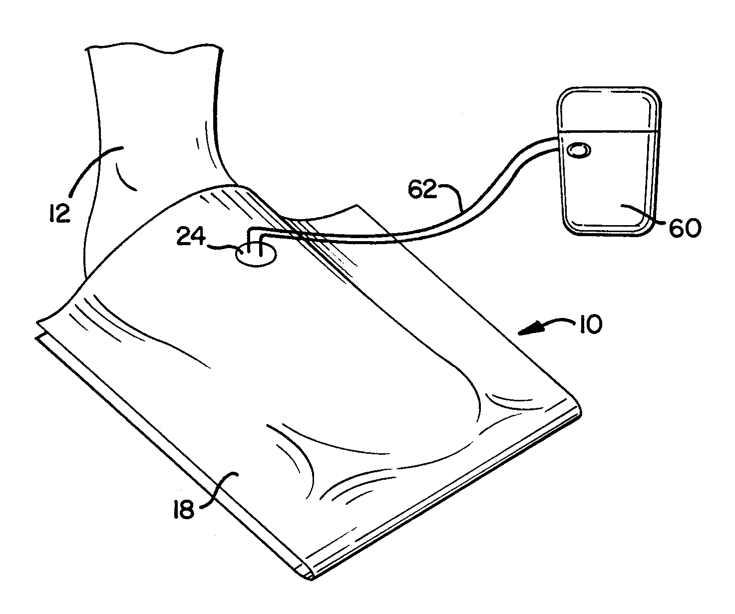 Negative pressure wound therapy device