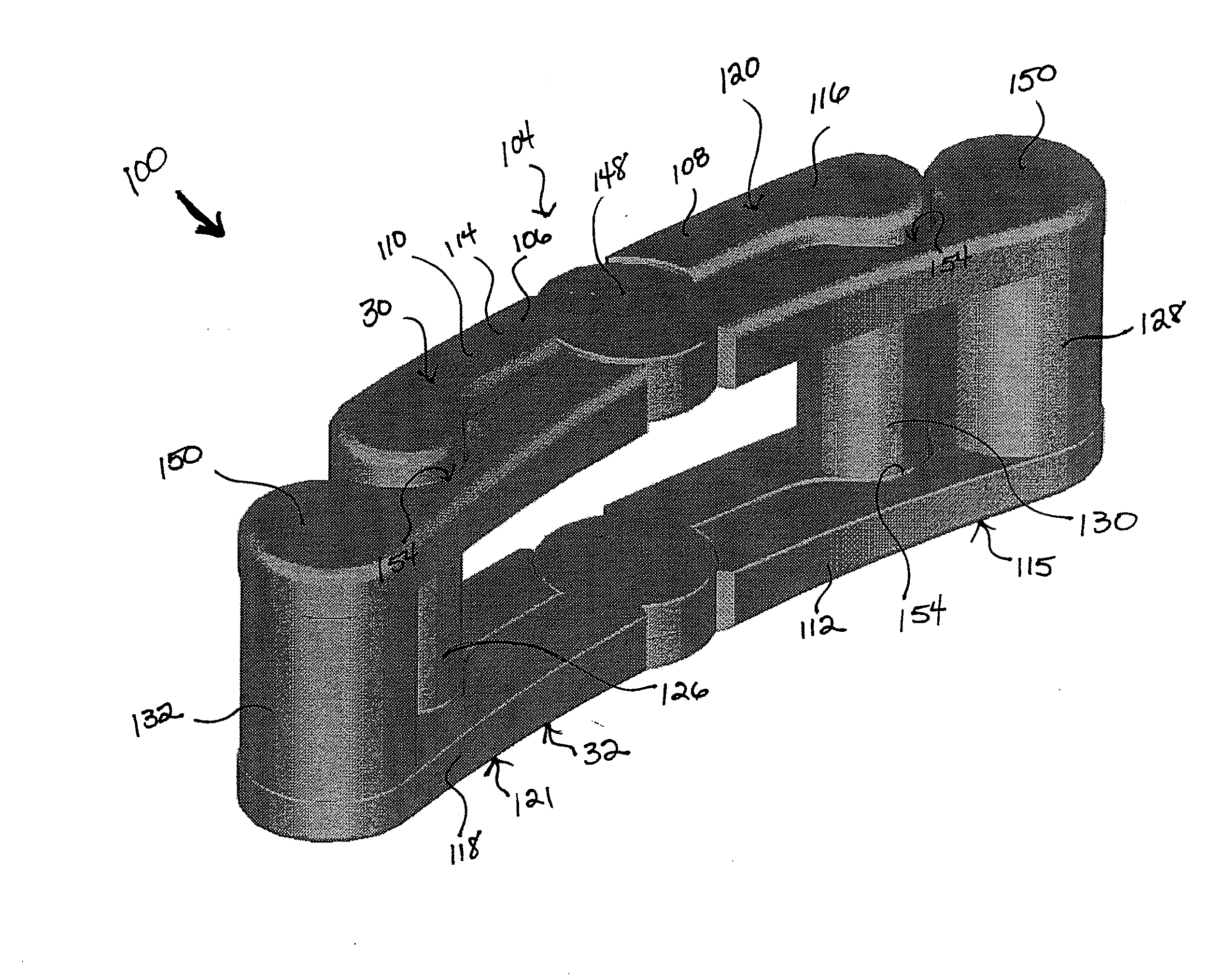 Spine surgery method and implant