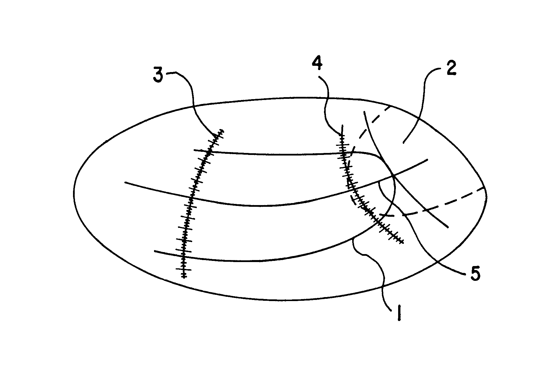 Arch wire, method for preparing the arch wire and spherical plate therefor