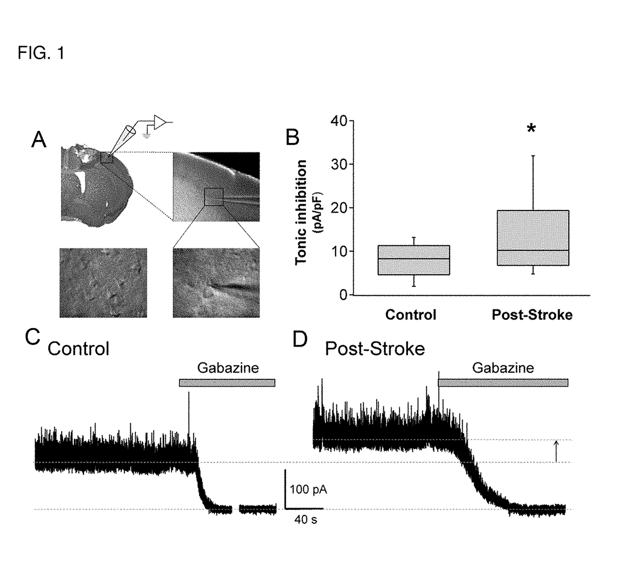 Methods and compositions for treating a subject for central nervous system (CNS) injury