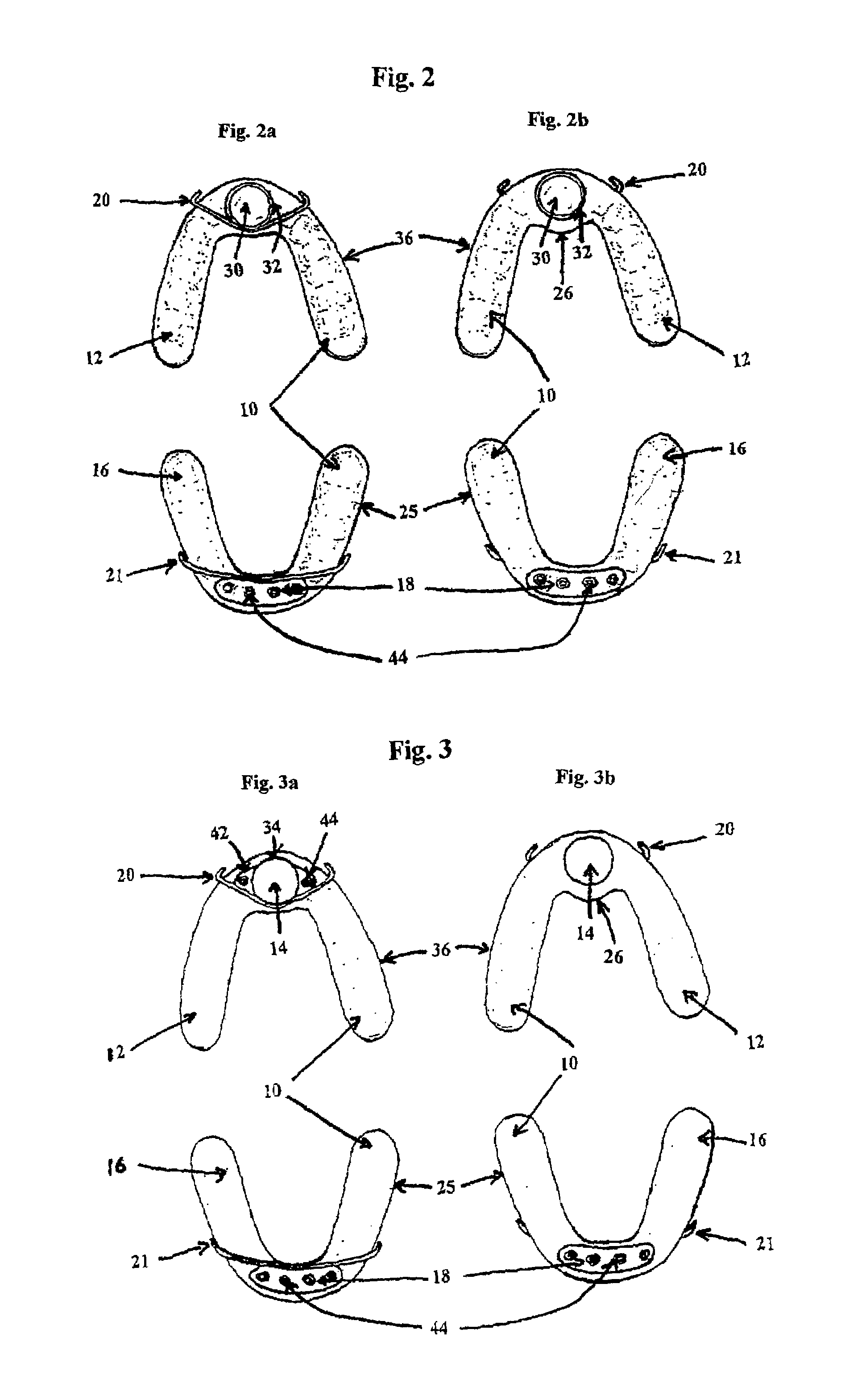 Magnetic dental appliance